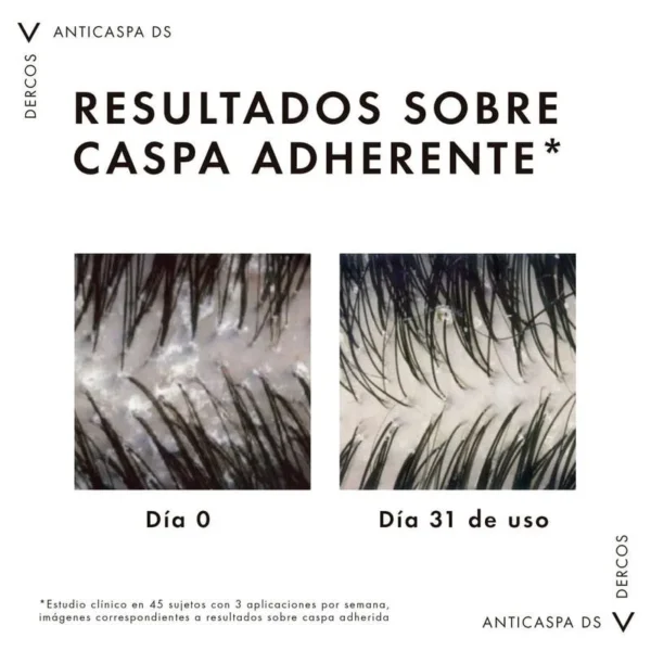 DERCOS SHAMPU ANTICASPA - Imagen 6